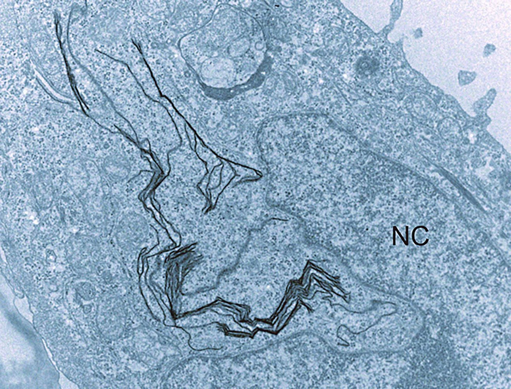 Graphene lungs
